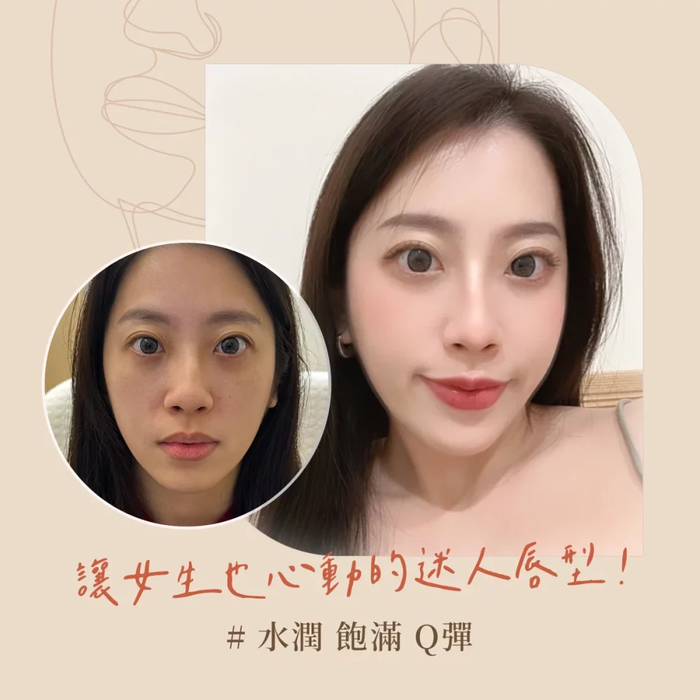 0114_IG_療程介紹_6