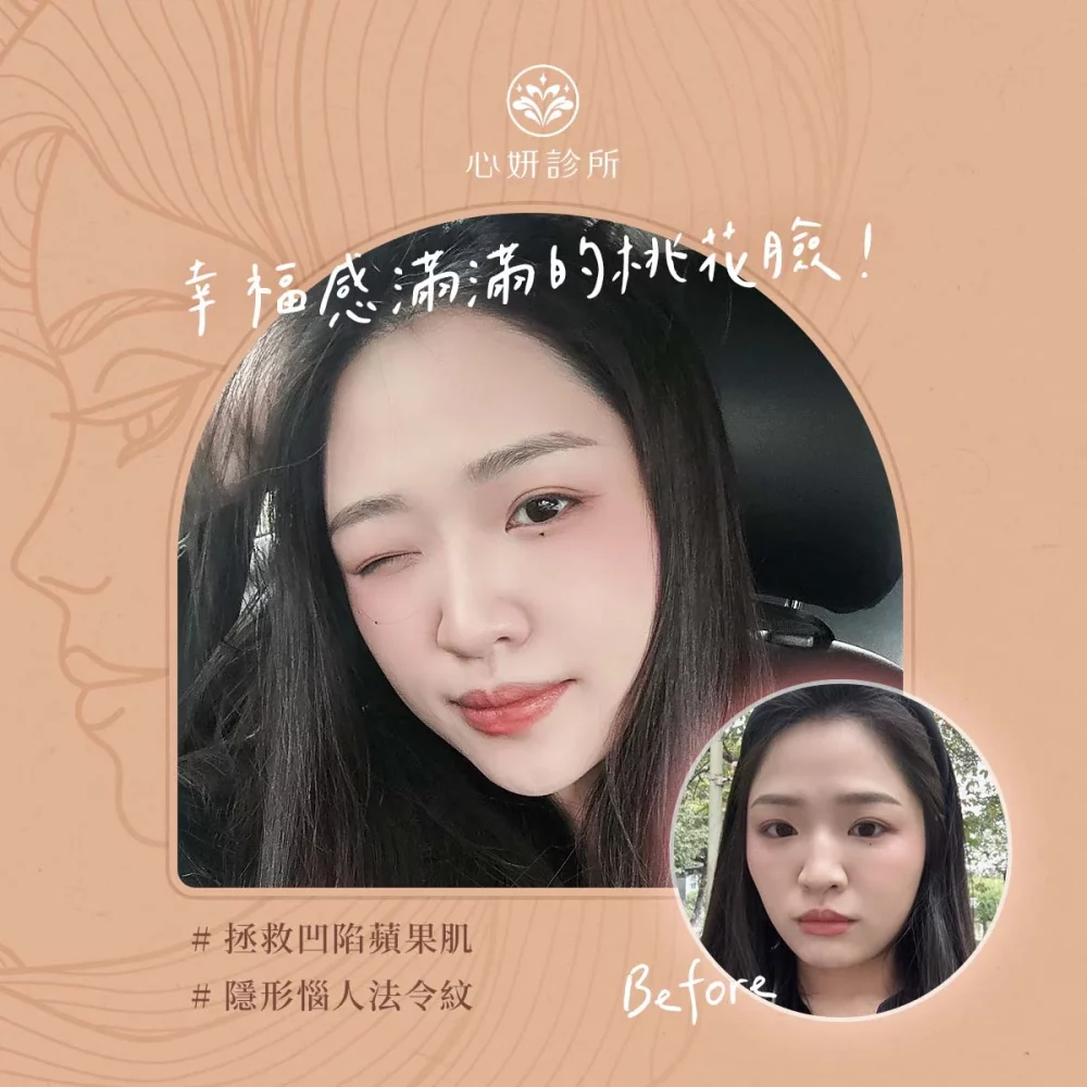 0323_IG_案例介紹_1