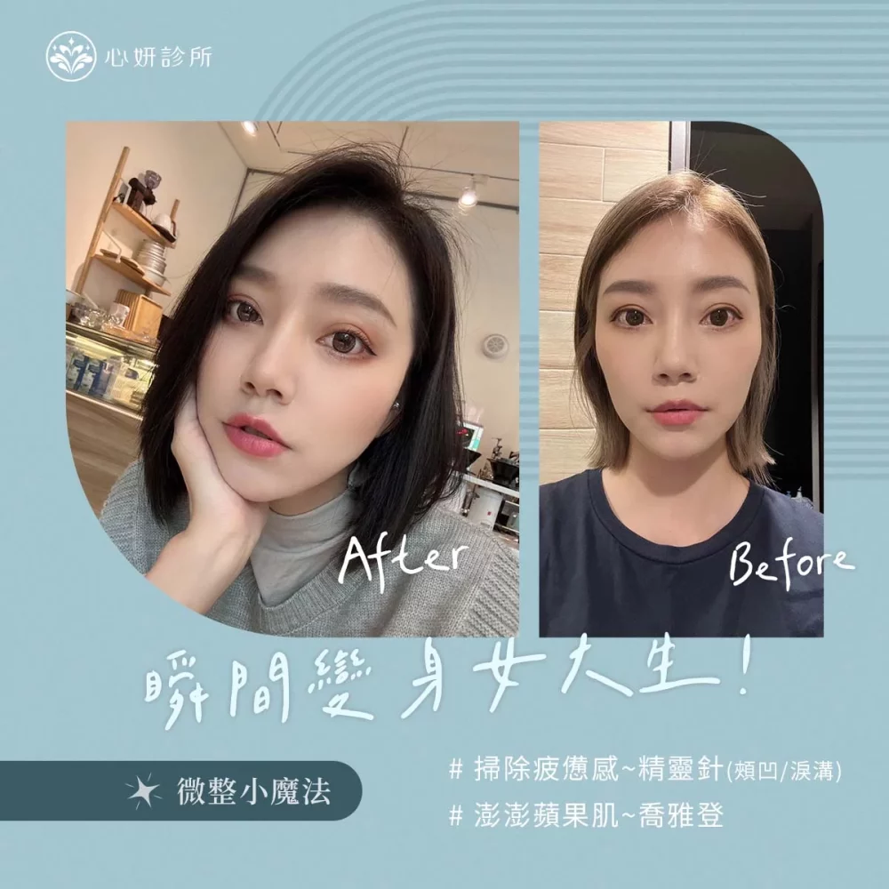 0514_FB_案例介紹_1