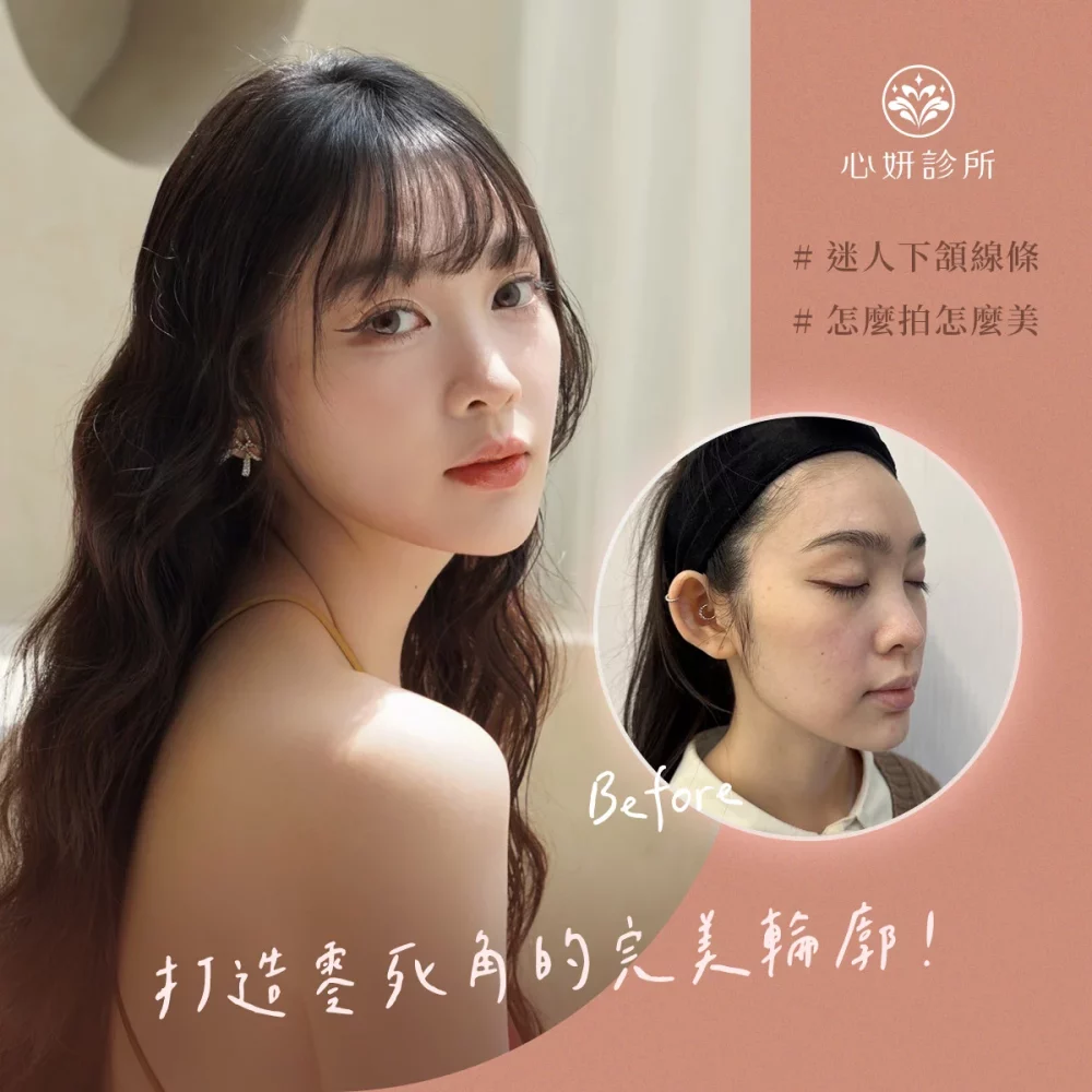 1120_IG_案例分享_1