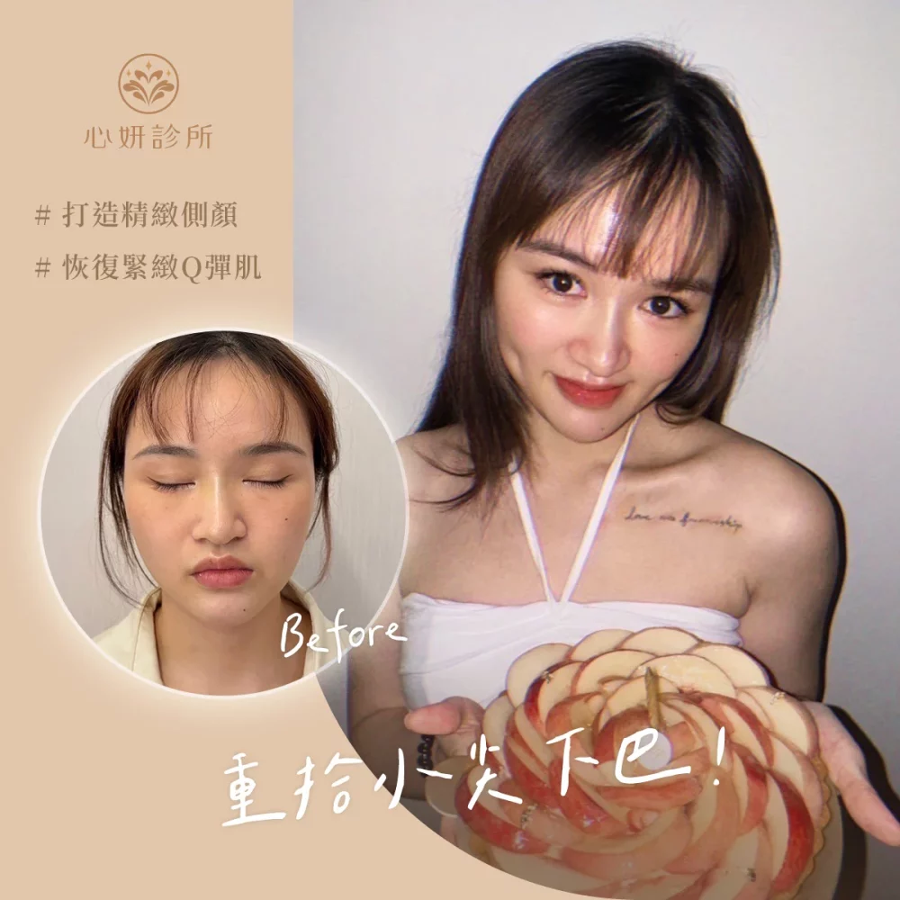 1125_IG_案例分享_1