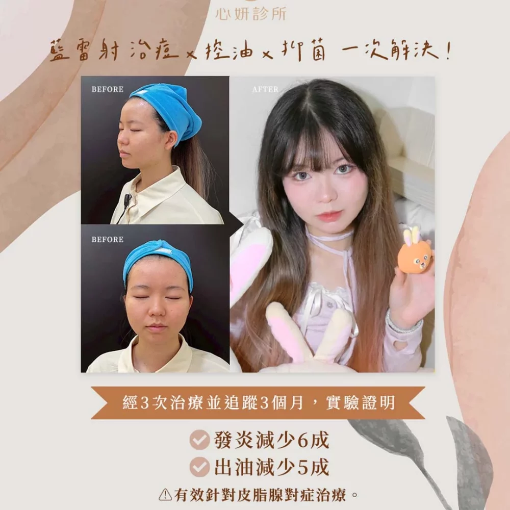未命名-2